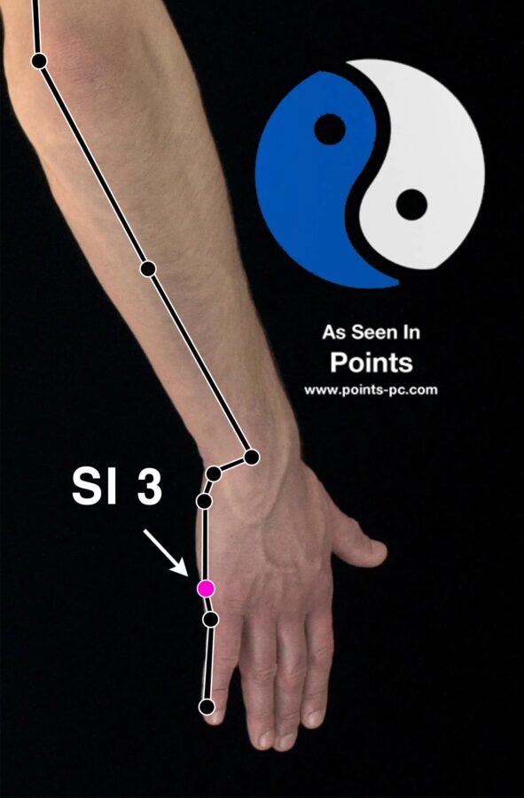 Migraine Headaches: 8 Pressure Points For Migraine Relief